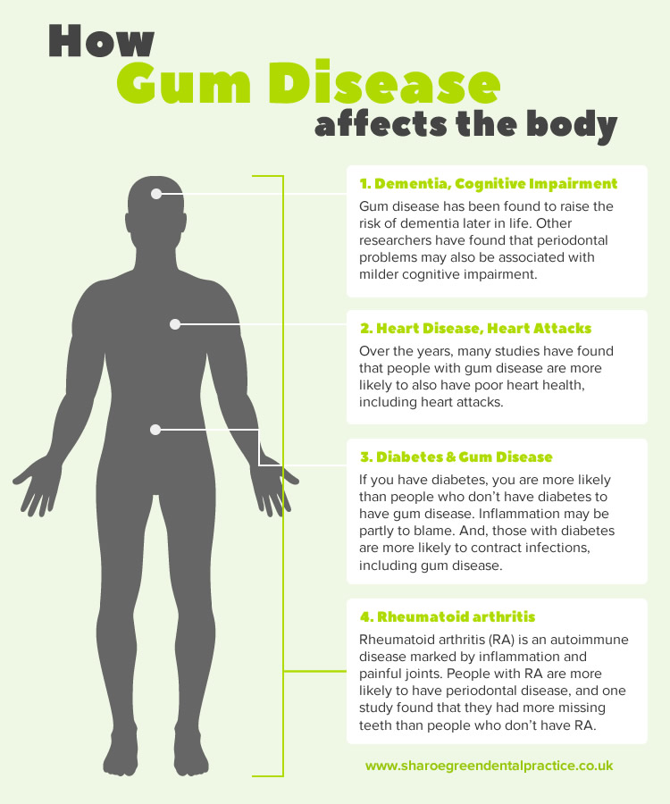 body-health-gum-disease